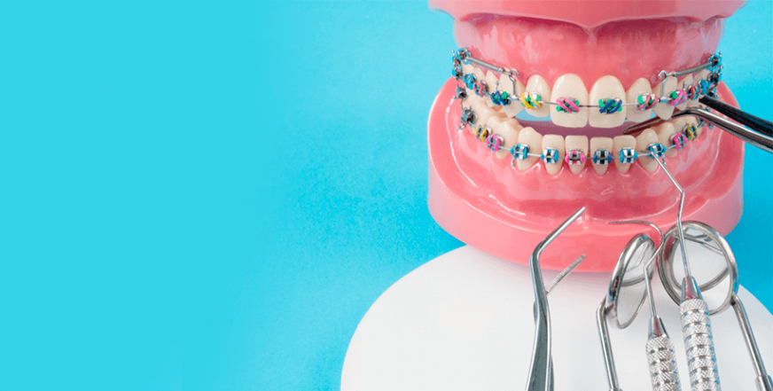 Ортодонтия