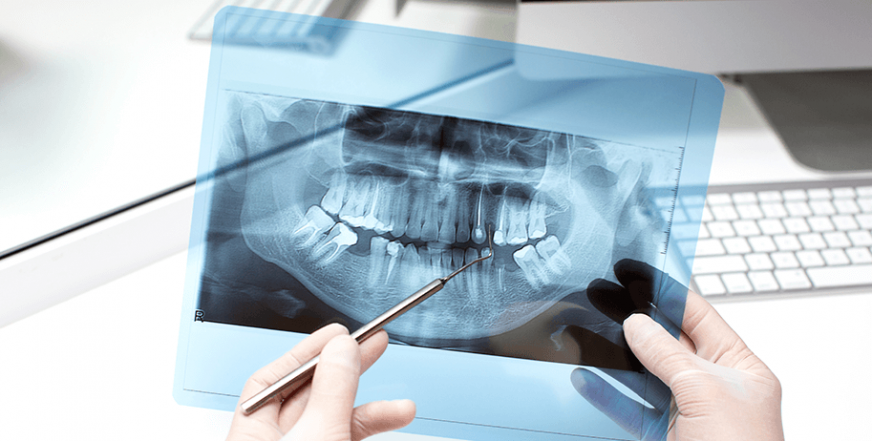 Рентген-диагностика